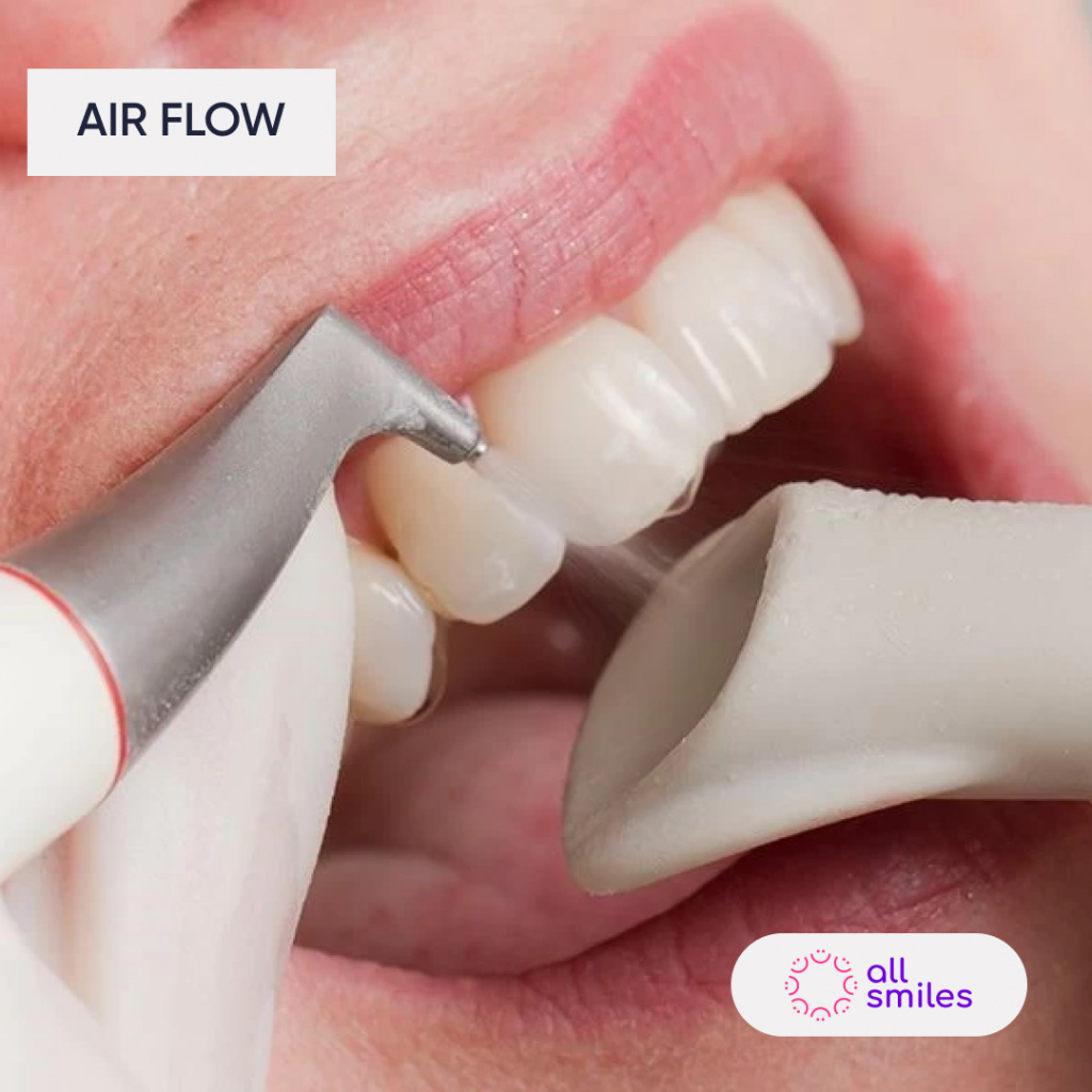 чистка зубов Air Flow