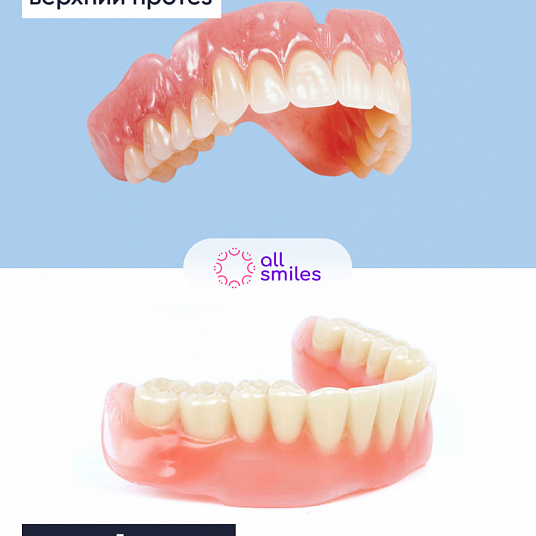 Протезирование зубов - виды