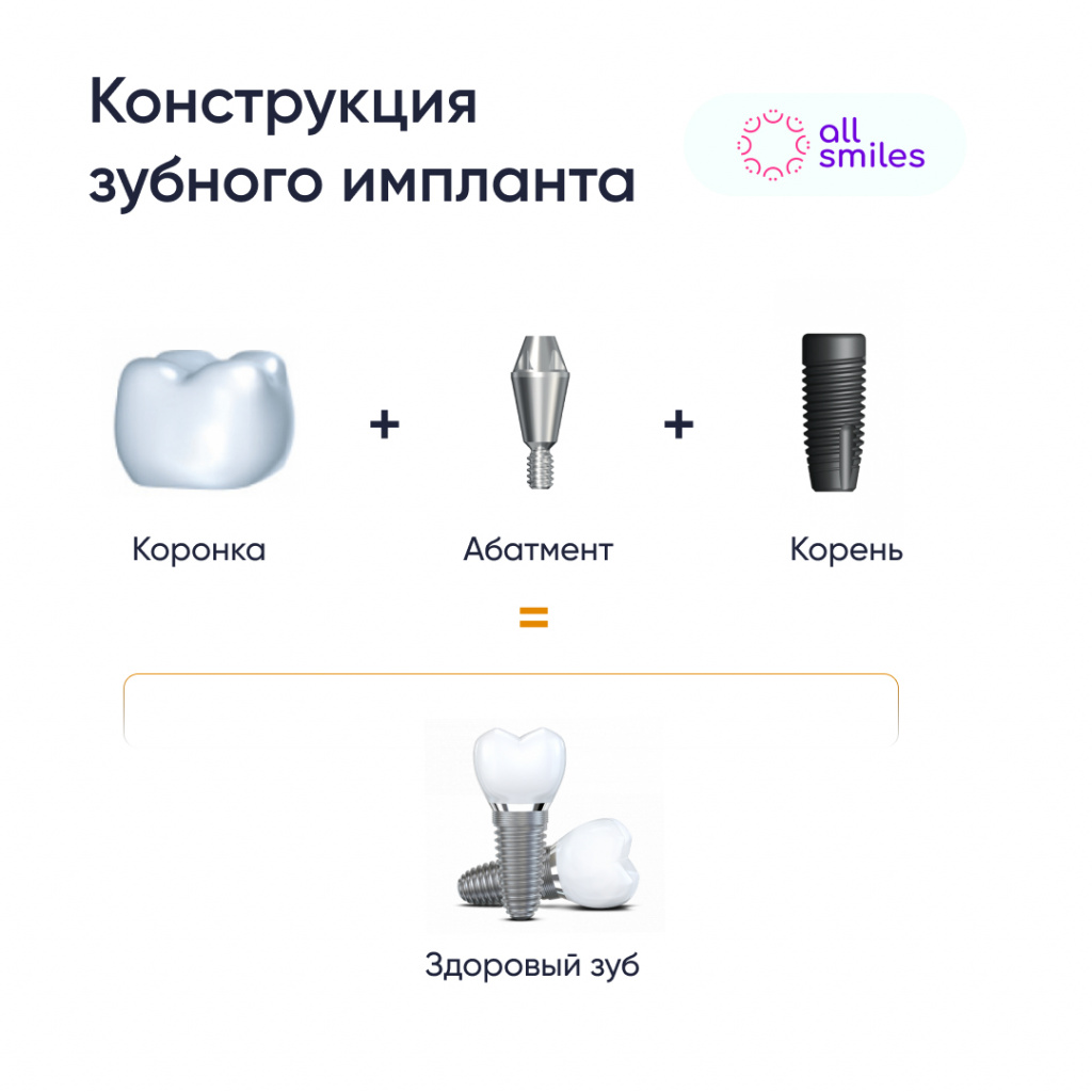 Конструкция зубного импланта и коронки.jpg