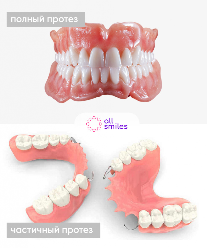 Полный и частичный протезы для зубов
